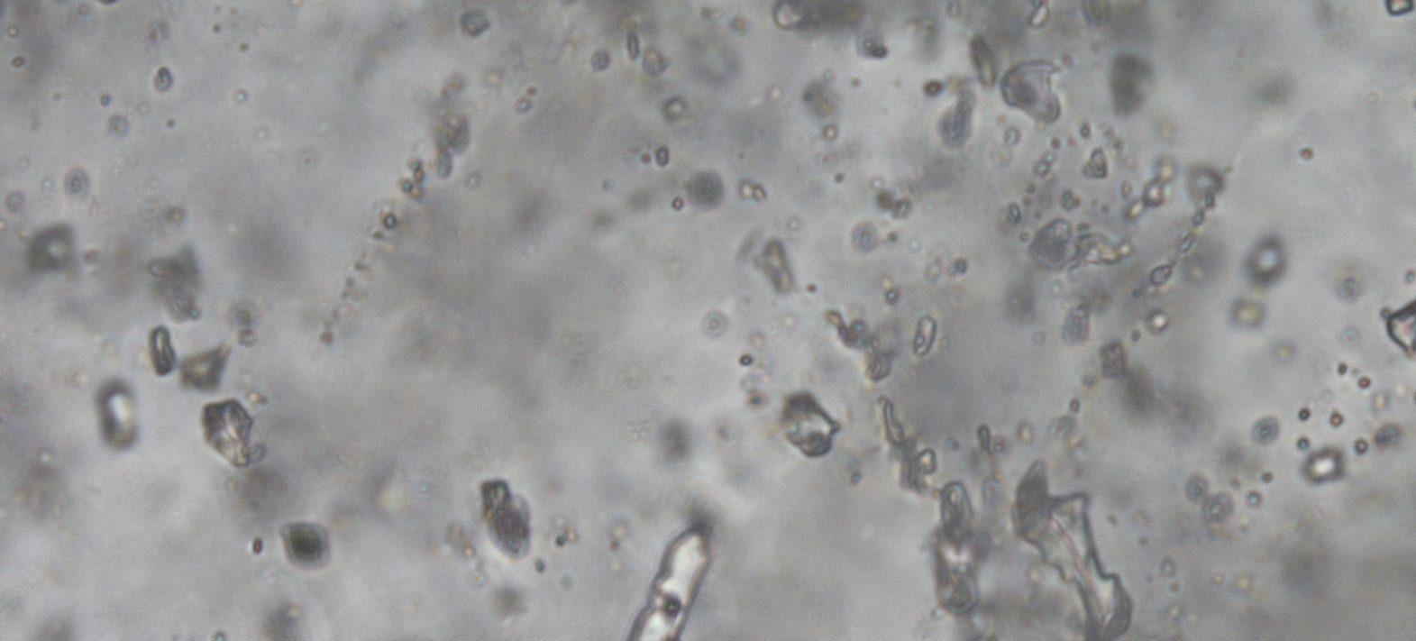 Un nouvel éclairage de l’histoire de l’atmosphère terrestre à travers les isotopes du néon et du xénon