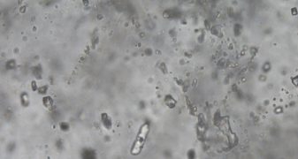 New insights into the history of Earth's atmosphere through neon and xenon isotopes.